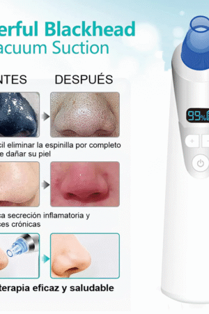 tratamiento facial